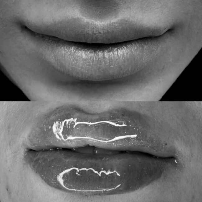 lips